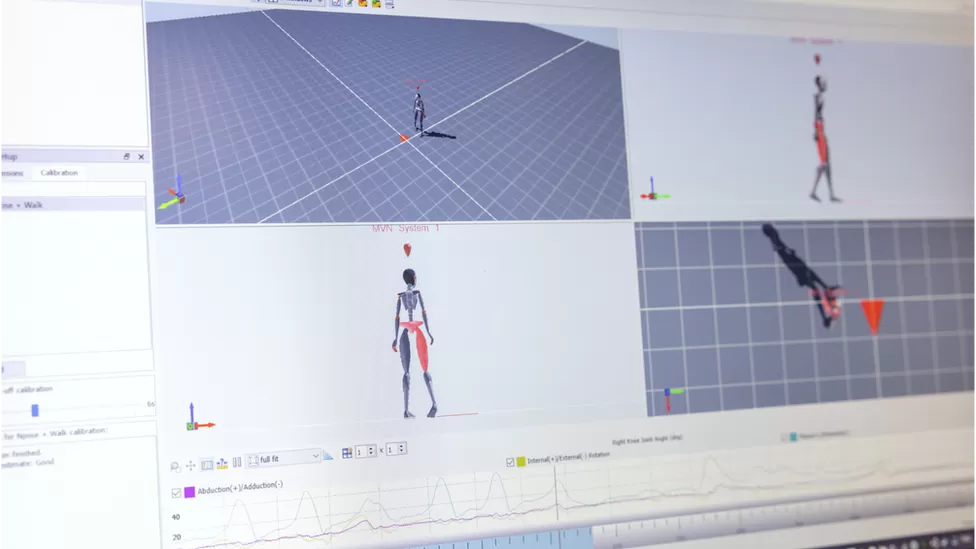 Motion Capture hjälper forskare förutspå sjukdomsförlopp